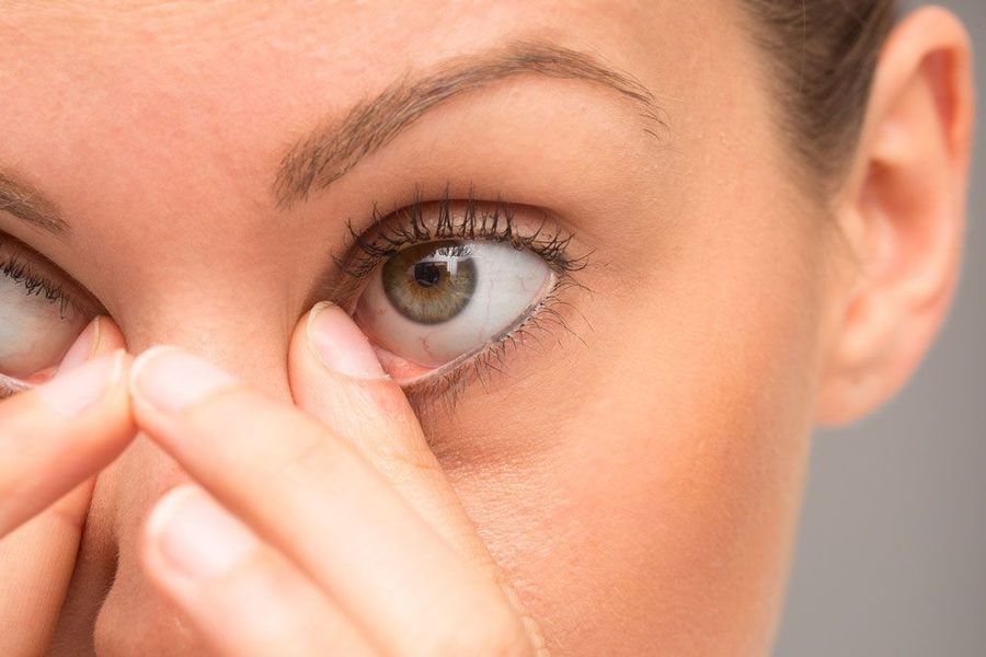 Woman struggling with Dry Eye